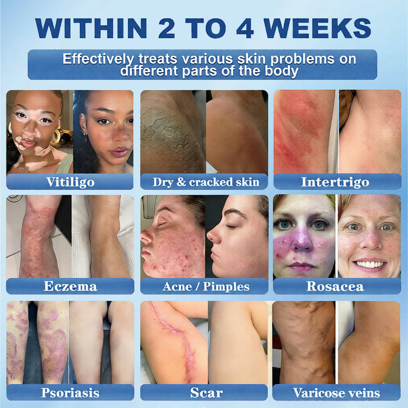 Official Store |🐳Awzlove® GHK-Cu · NAD+ Peptide · EGT 10-in-1 Bio-Hacking Ultimate Ampoule | for Cellular Repair & Skin Longevity,From Acne & Redness to Deep Wrinkles & Laxity (Visible Results in 7 Days)