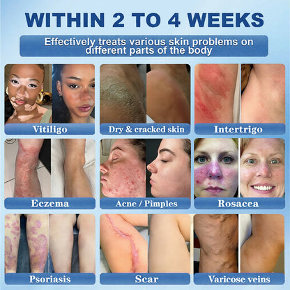Official Store |🐳Awzlove® GHK-Cu · NAD+ Peptide · EGT 10-in-1 Bio-Hacking Ultimate Ampoule | for Cellular Repair & Skin Longevity,From Acne & Redness to Deep Wrinkles & Laxity (Visible Results in 7 Days)