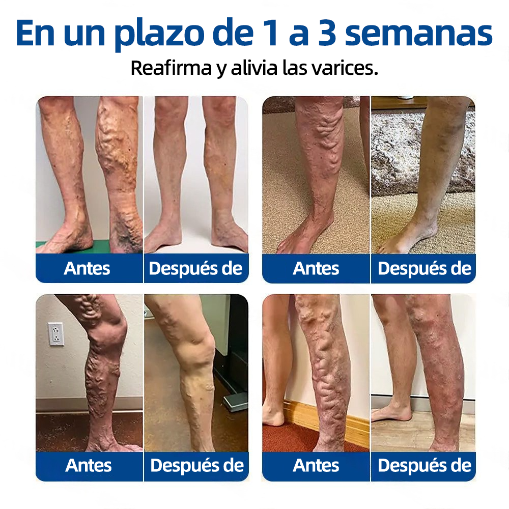 𝗛𝗲𝗮𝗹𝗿𝗶𝘇𝗲® 𝗣𝗮𝗿𝗰𝗵𝗲 𝗠𝗶𝗰𝗿𝗼𝗻𝗲𝗲𝗱𝗹𝗲 𝗩𝗲𝗶𝗻𝗧𝗮𝗿𝗴𝗲𝘁 𝗔𝗹𝗶𝘃𝗶𝗼 𝗜𝗻𝘀𝘁𝗮𝗻𝘁𝗮́𝗻𝗲𝗼, 𝗥𝗲𝘀𝘂𝗹𝘁𝗮𝗱𝗼𝘀 𝗮 𝗟𝗮𝗿𝗴𝗼 𝗣𝗹𝗮𝘇𝗼🌾🌿🇪🇸