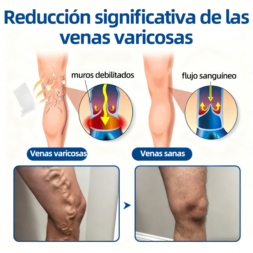 𝗛𝗲𝗮𝗹𝗿𝗶𝘇𝗲® 𝗣𝗮𝗿𝗰𝗵𝗲 𝗠𝗶𝗰𝗿𝗼𝗻𝗲𝗲𝗱𝗹𝗲 𝗩𝗲𝗶𝗻𝗧𝗮𝗿𝗴𝗲𝘁 𝗔𝗹𝗶𝘃𝗶𝗼 𝗜𝗻𝘀𝘁𝗮𝗻𝘁𝗮́𝗻𝗲𝗼, 𝗥𝗲𝘀𝘂𝗹𝘁𝗮𝗱𝗼𝘀 𝗮 𝗟𝗮𝗿𝗴𝗼 𝗣𝗹𝗮𝘇𝗼🌾🌽🇪🇸
