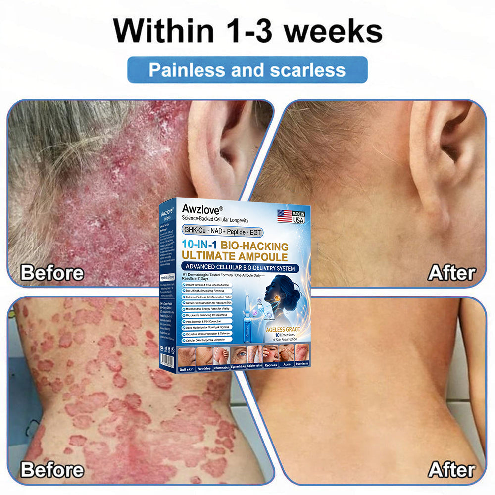 Official Store |🐳Awzlove® GHK-Cu · NAD+ Peptide · EGT 10-in-1 Bio-Hacking Ultimate Ampoule | for Cellular Repair & Skin Longevity,From Acne & Redness to Deep Wrinkles & Laxity (Visible Results in 7 Days)