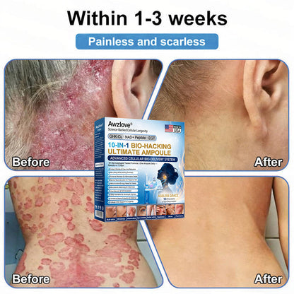 Official Store |🐳Awzlove® GHK-Cu · NAD+ Peptide · EGT 10-in-1 Bio-Hacking Ultimate Ampoule | for Cellular Repair & Skin Longevity,From Acne & Redness to Deep Wrinkles & Laxity (Visible Results in 7 Days)