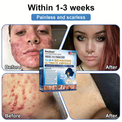 Official Store |🐳Awzlove® GHK-Cu · NAD+ Peptide · EGT 10-in-1 Bio-Hacking Ultimate Ampoule | for Cellular Repair & Skin Longevity,From Acne & Redness to Deep Wrinkles & Laxity (Visible Results in 7 Days)